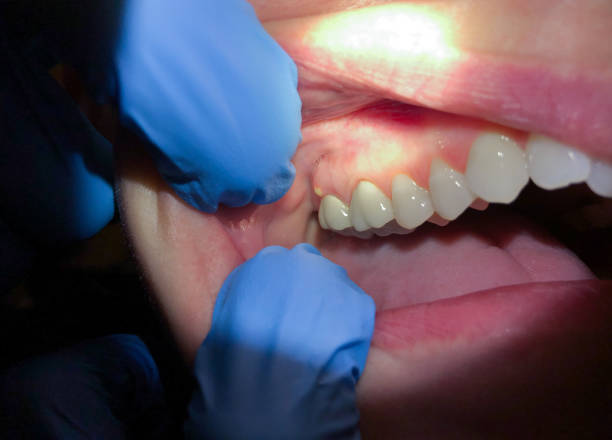 Best Pediatric Emergency Dentist in Spring Valley, CA